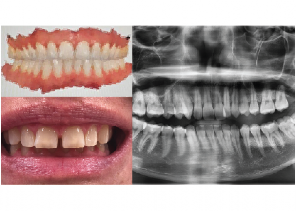 necessary records resized